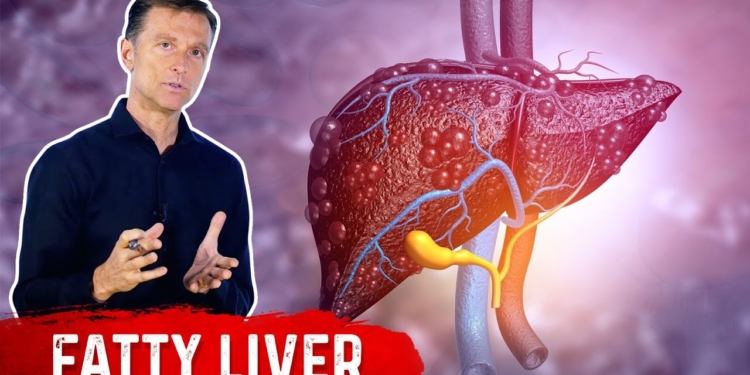 Why Does a Fatty Liver Have No Symptoms? – NAFLD (Non Alcoholic Fatty Liver Disease) by Dr.Berg