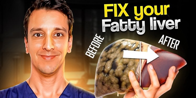 Fix your Fatty Liver with THIS workout