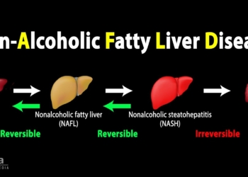 Nonalcoholic Fatty Liver Disease (NAFLD), Animation