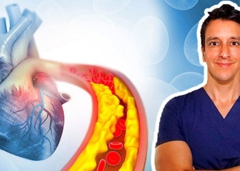 Atherosclerosis | Cholesterol, LDL, HDL, Triglycerides