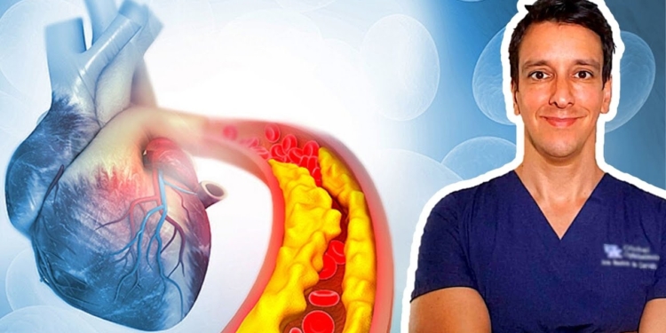 Atherosclerosis | Cholesterol, LDL, HDL, Triglycerides