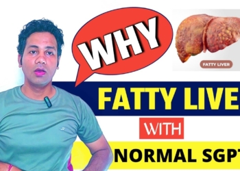 Fatty Liver Or normal or High SGPT , SGOT ?