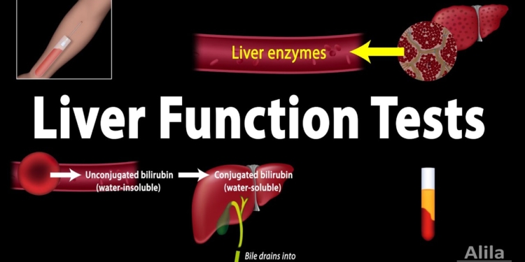 Liver Function Tests (LFTs), Animation
