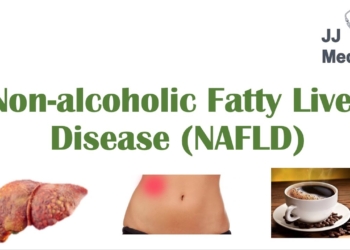 Non-Alcoholic Fatty Liver Disease, Risk Factors, Symptoms (ex. Fatigue), Treatment (ex. Coffee)