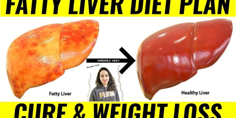 Fatty Liver Diet Plan | Diet Plan For Fatty Liver Patients | Diet Chart To Cure Fatty Liver NAFLD