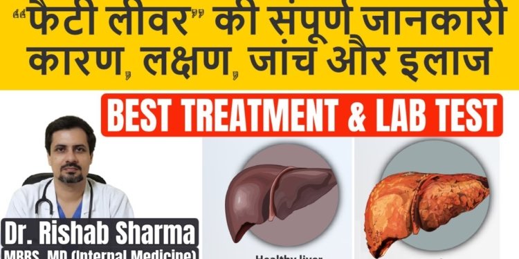 Fatty Liver: Causes, Symptoms, Investigation, Treatment in Hindi II Fatty liver ke lakshan II ThyDoc