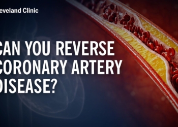 Can You Reverse Coronary Artery Disease?