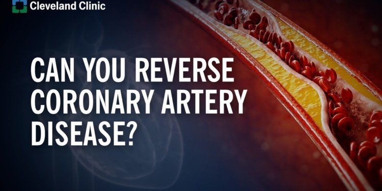 Can You Reverse Coronary Artery Disease?
