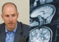 Split-screen image featuring a man in a blazer and button-down shirt speaking into a microphone on the left, and a series of medical brain scans showing cross-sections of a human head on the right.