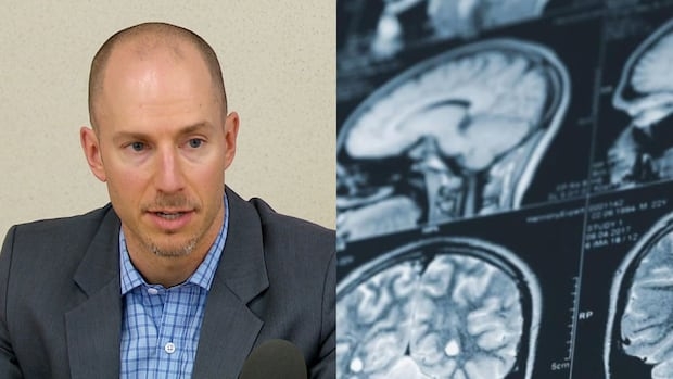 Split-screen image featuring a man in a blazer and button-down shirt speaking into a microphone on the left, and a series of medical brain scans showing cross-sections of a human head on the right.