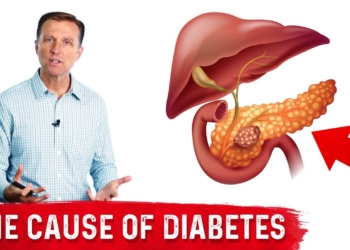Your Fatty Pancreas Caused Your Diabetes