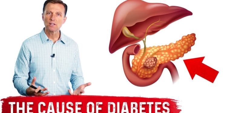 Your Fatty Pancreas Caused Your Diabetes