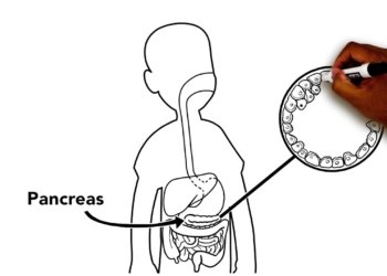 What is Diabetes?: Type 1 Diabetes Education from Phoenix Children's