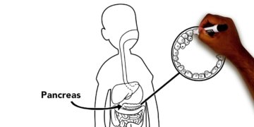 What is Diabetes?: Type 1 Diabetes Education from Phoenix Children's