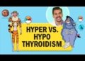 Hyperthyroidism vs. Hypothyroid RN LPN NCLEX