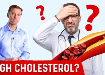 Dr. Berg's Wife Has Crazy High Cholesterol of 261..