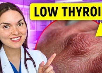 15 Signs of HYPOTHYROIDISM You Can See: Doctor Explains