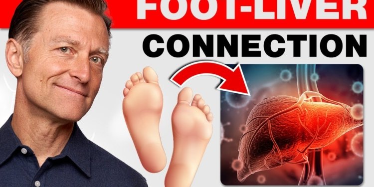 How Your Feet Are Warning You About Your Liver Problems - Dr. Berg Explains