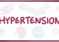 Hypertension- causes, symptoms, diagnosis, treatment, pathology