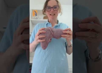 The stages of fatty liver disease