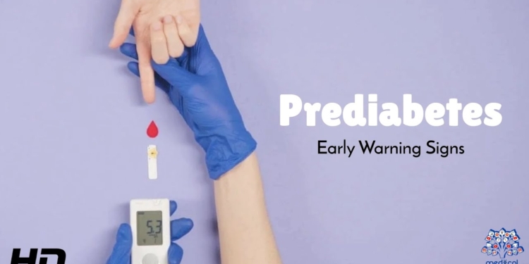 Prediabetes Early Warning Signs You Should Never Ignore