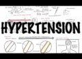 Hypertension - Overview (causes, pathophysiology, investigations, treatment