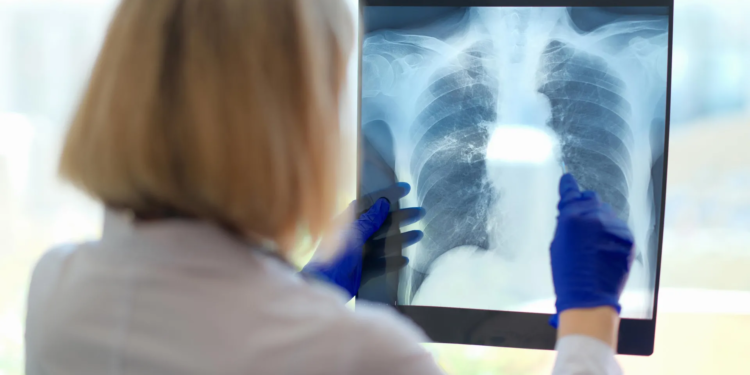 A hidden breathing problem may be behind chronic fatigue’s crushing exhaustion