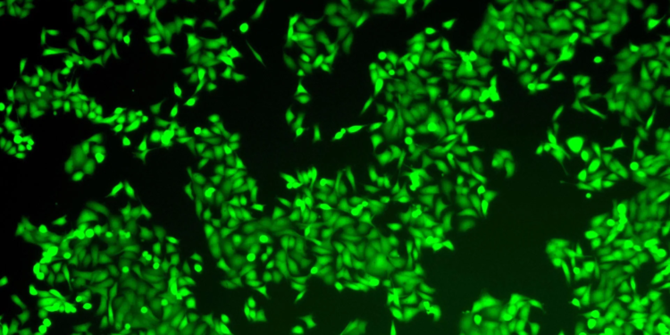 A hidden loop is powering deadly pancreatic cancer