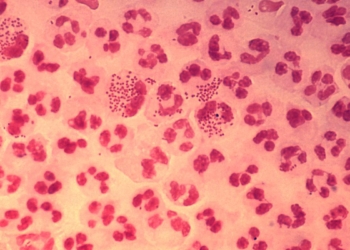 All you need to know about: gonorrhoea