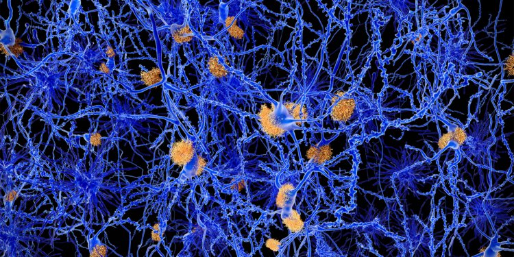 Alzheimer's Risk May Be Driven by a Single Gene