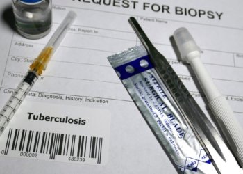 At 145, Mizoram recorded six-year high TB deaths in 2025