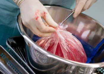 CMS Makes Push to Maximize Donor Organs, Even the Imperfect Ones