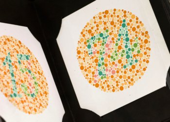 Color Blindness and Bladder Cancer: A Bad Combination for Survival?