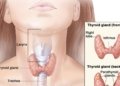 Do you think you have a malfunctioning thyroid? Doctors say, consult before testing