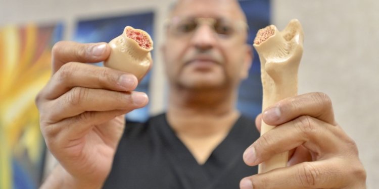 From the Vault: Hip fractures in the elderly, like Tun Mahathir, are serious