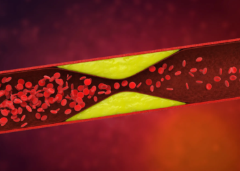 Hidden in your dna: The mutation combo that raises clot risk by 180%