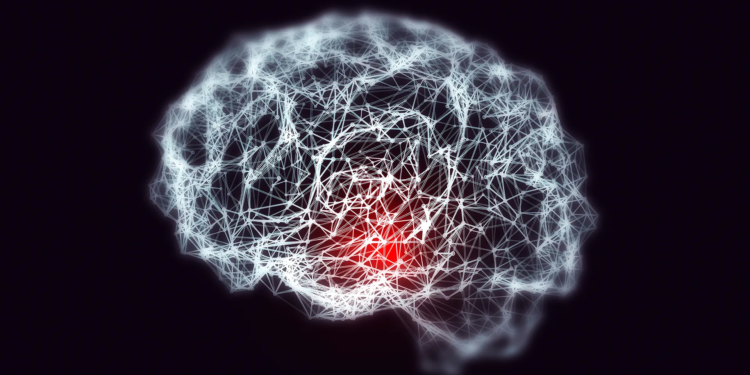 Iron overload: The hidden culprit behind early Alzheimer’s in Down syndrome