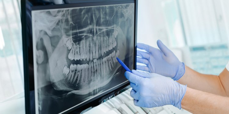 Is Radiation from Dental X-Rays Harmful? | American Association of Orthodontists