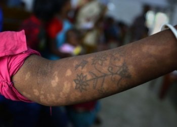 Kala Azar in India: Treading the last mile towards elimination