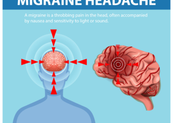 Migraine is not just a headache – New science is rewriting the migraine story