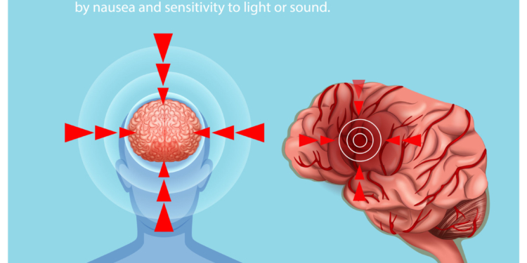 Migraine is not just a headache – New science is rewriting the migraine story