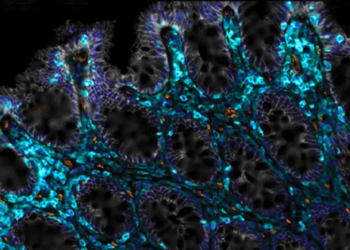 Scientists found a way to help aging guts heal themselves