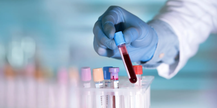 Simple test could better predict your risk of heart disease