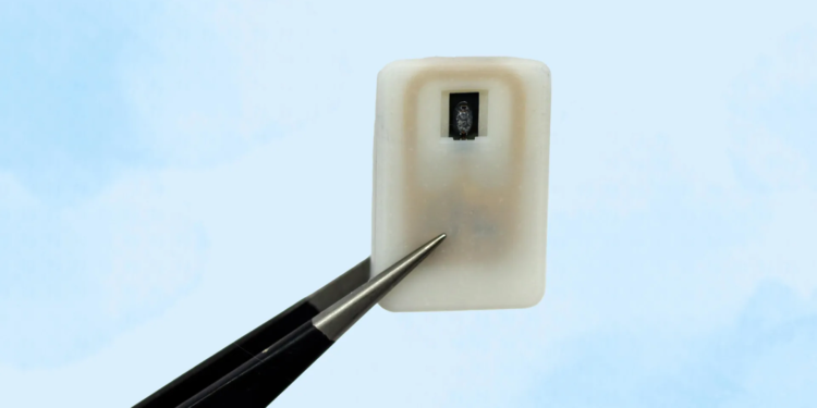 This tiny implant could save diabetics from silent, deadly crashes