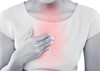 Understanding, managing, and preventing the “burn”