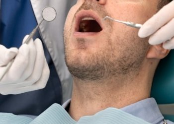 wisdome tooth removal