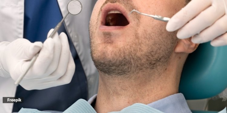 wisdome tooth removal