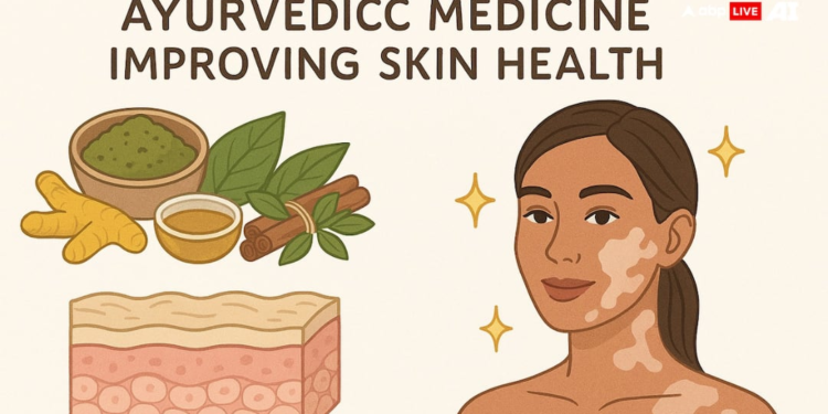 सफेद दाग का आयुर्वेदिक समाधान! मेलानोग्रिट से विटिलिगो और ल्यूकोडर्मा का जड़ से उपचार