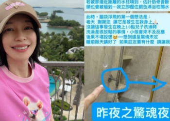 Actress Vivian Hsu shares bathroom accident that left her shaken: 'My ribs could have broken'
