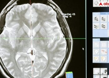 दिमाग के कीड़ों से बच्चों को कैसे पड़ते हैं दौरे? डॉक्टर से समझें खतरा और बचने के तरीके